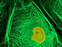 Le cancer sévit toujours dans le monde