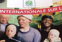 Les albinos, ravis de l’évolution de leur situation sécuritaire au Burundi