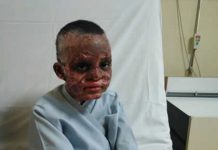 SOS : Plus de 40 millions à payer à l’hôpital pour libérer un enfant victime d’un incendie